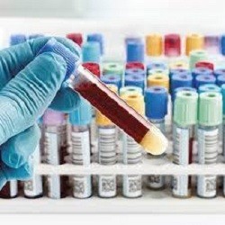  Human Prothrombin Complex Market